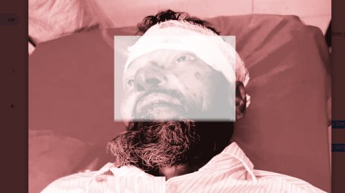 নোয়াখালীর সেনবাগে সিএনজি উল্টে বৃদ্ধের মৃত্যু!