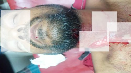 চালকের গলা কেটে অটোরিকশা ছিনতাই।