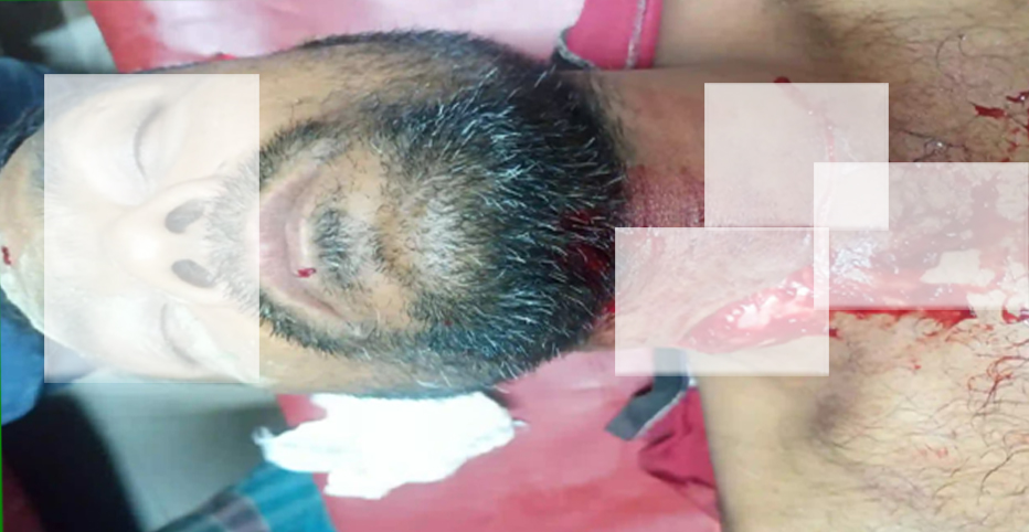 চালকের গলা কেটে অটোরিকশা ছিনতাই।
