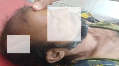 ভাতিজার লাঠির আঘাতে চাচার মৃত্যু!
