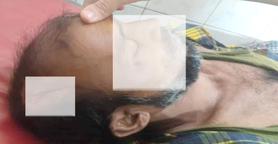 ভাতিজার লাঠির আঘাতে চাচার মৃত্যু!