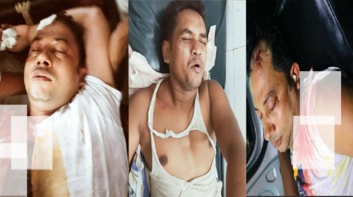 নোয়াখালীর কোম্পানীগঞ্জে দুই গ্রুপের সংঘর্ষে আহত-৪