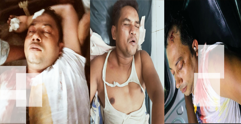 নোয়াখালীর কোম্পানীগঞ্জে দুই গ্রুপের সংঘর্ষে আহত-৪