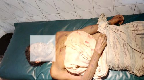 নোয়াখালীতে ঘর নির্মাণে মারামারিতে এক বৃদ্ধের মৃত্যু