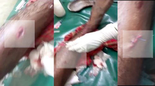 নোয়াখালীতে যুবলীগ নেতাকে তুলে নিয়ে গুলি