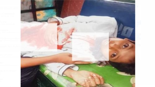 পাওনা টাকা চাওয়ায় বন্ধুর পেটে ছুরি মেরেছে বন্ধু