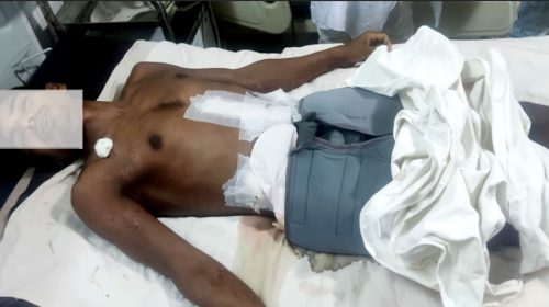 হাতিয়ার মেঘনায় জলদস্যুদের গুলিতে আহত আরেক জেলের মৃত্যু
