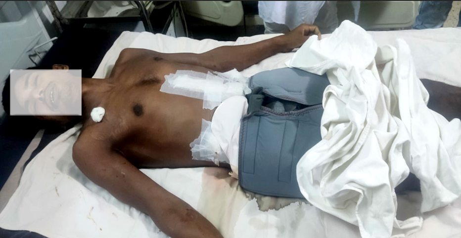 হাতিয়ার মেঘনায় জলদস্যুদের গুলিতে আহত আরেক জেলের মৃত্যু