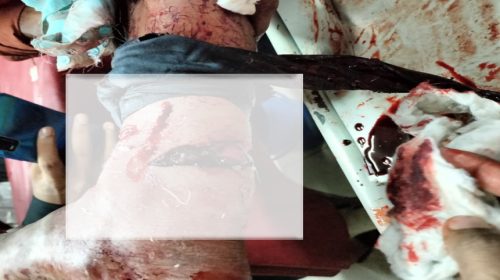 স্বেচ্ছাসেবক লীগ নেতার পায়ের রগ কাটার অভিযোগ যুবলীগ কর্মীর বিরুদ্ধে