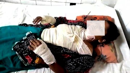 নোয়াখালীতে গৃহবধূকে পুড়িয়ে হত্যার চেষ্টার অভিযোগে গ্রেপ্তার ৪