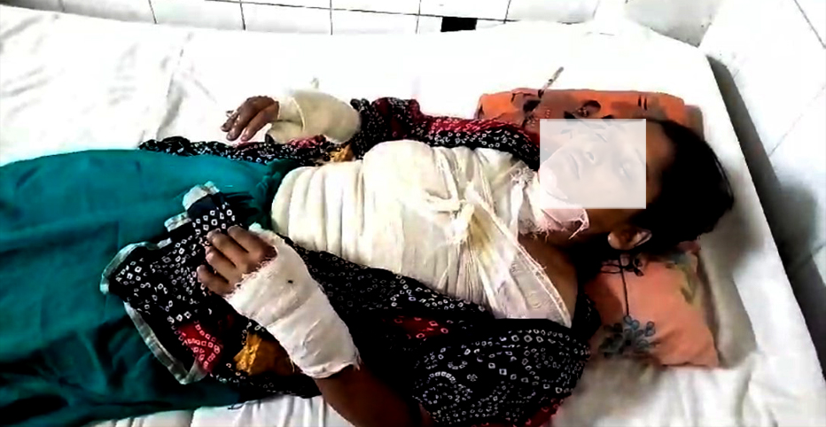 নোয়াখালীতে গৃহবধূকে পুড়িয়ে হত্যার চেষ্টার অভিযোগে গ্রেপ্তার ৪