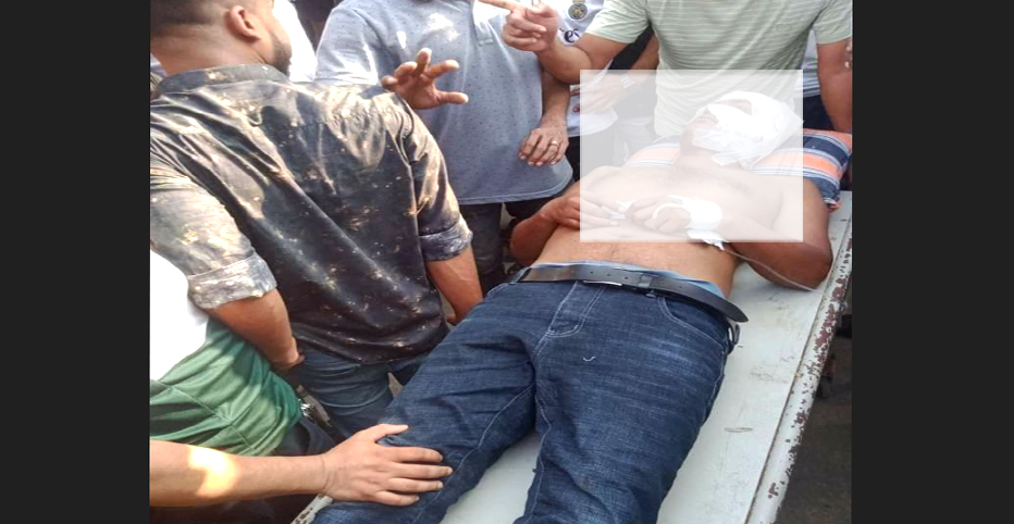 নোয়াখালীতে যুবলীগের দুই গ্রুপে সংঘর্ষ, গুলি বিদ্ধসহ আহত ৬