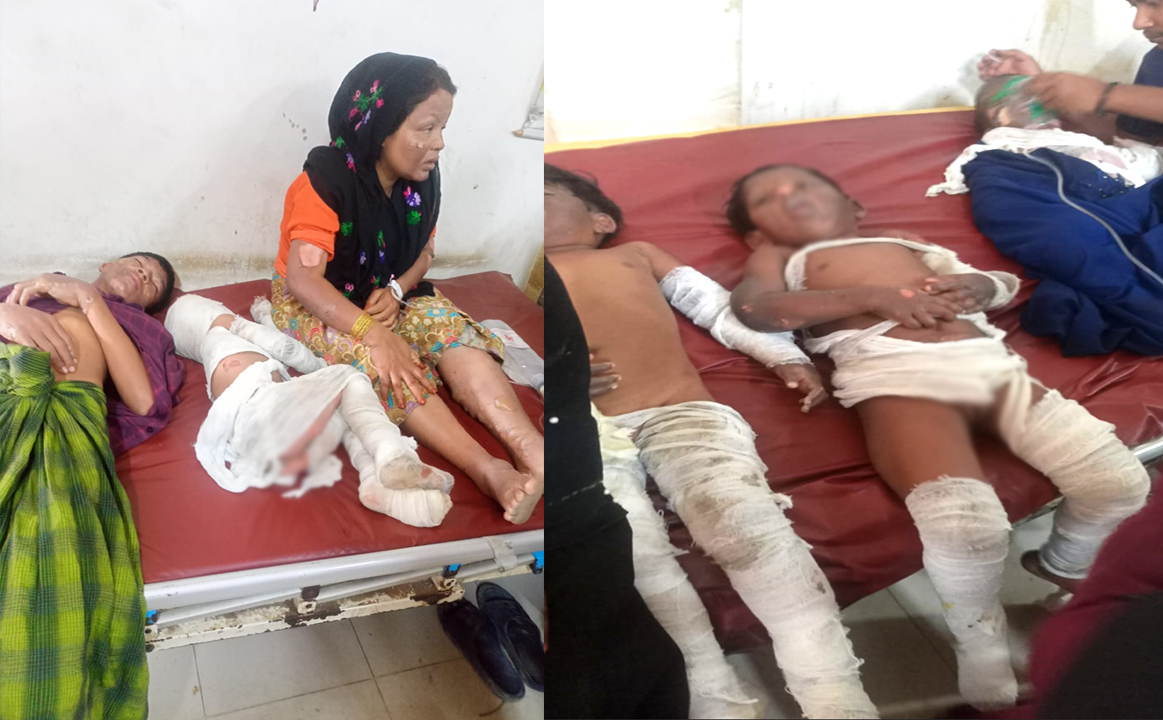 নোয়াখালীর রোহিঙ্গা ক্যাম্পে বিস্ফোরণ: মৃতের সংখ্যা বেড়ে-৩  
