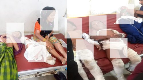 নোয়াখালী রোহিঙ্গা ক্যাম্পে গ্যাস সিলিন্ডার বিস্ফোরণে ৯জন দগ্ধ, ১ শিশুর মৃত্যু