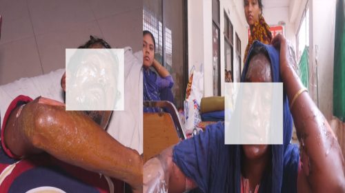 নোয়াখালীতে বিদ্যুতের তার ছিঁড়ে বৃদ্ধের মৃত্যু, দগ্ধ-৩  