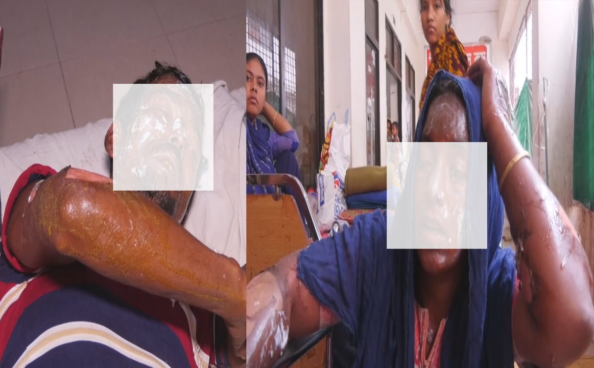 নোয়াখালীতে বিদ্যুতের তার ছিঁড়ে বৃদ্ধের মৃত্যু, দগ্ধ-৩  