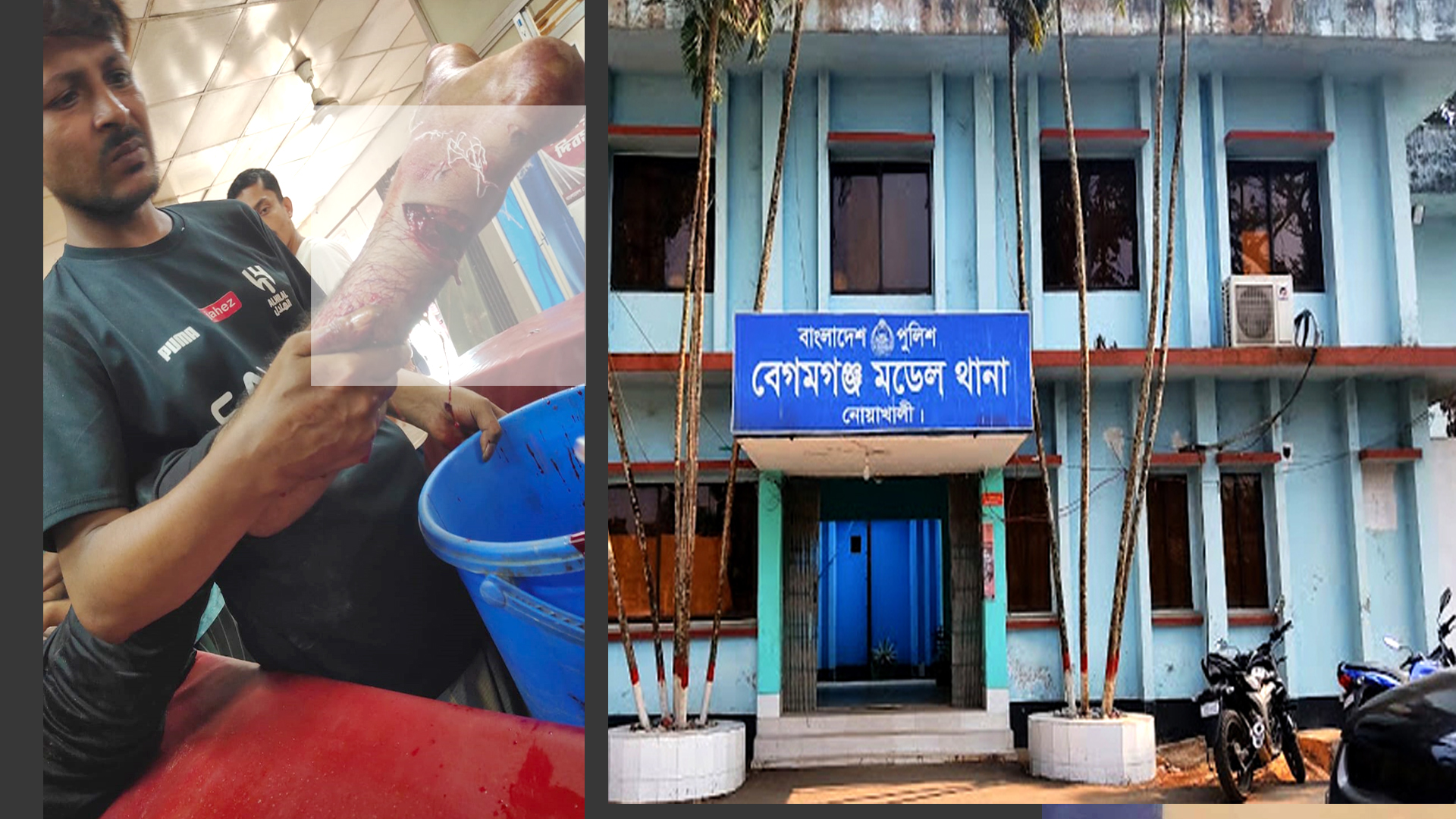 নোয়াখালীতে এলোপাতাড়ি কুপিয়ে তরুণের হাত-পায়ের রগ কাটল সন্ত্রাসীরা 